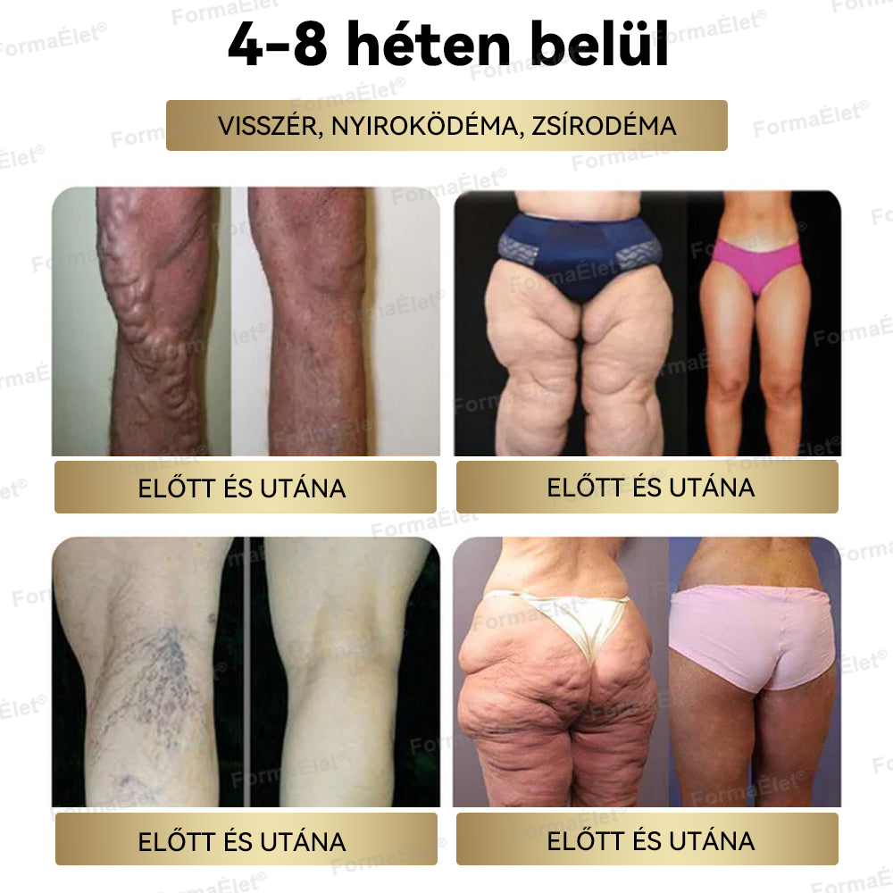A Mayo Clinic által ajánlott | Hivatalos üzlet | FormaÉlet® GLP-1 Moringa Fogyókúrás és Egészségfokozó cseppek (Élelmiszer-minőségű zsírégető – Az Obesity Society fejlesztése)🔥🔥🔥