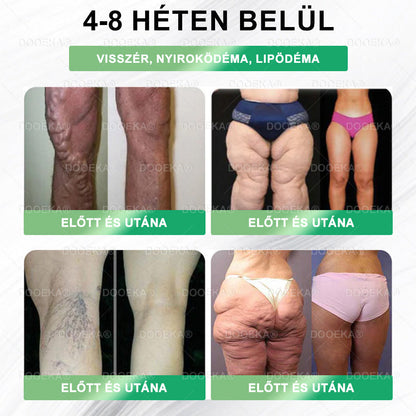 🌿DOOEKA® GLP-1 8 az 1-ben Fit & Vital Szájon át szedhető oldat – Napi egyszer, 7 nap alatt látható változás / Elhízás, szív- és érrendszeri egészség, cukorbetegség, alvási apnoe, bélrendszer egészsége, ízületi problémák és még sok más esetén✅